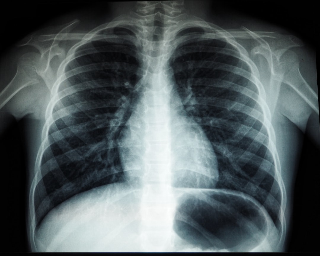 Badania Radiograficzne – Kluczowe Narzędzie Diagnostyczne w Medycynie